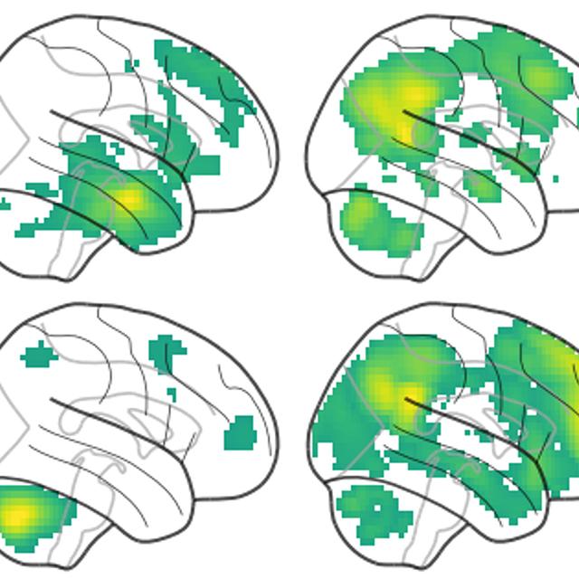Une équipe de recherche de l'Université de Bâle a décrypté les signaux cérébraux nécessaires à une bonne mémoire. [University of Basel/Nature Communications - Hirnaktivitäten, de Quervain/MCN]