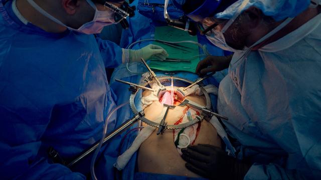 Une équipe de chirurgiens du NYU Langone Health Hospital lors de la transplantation d'un rein de porc dans un patient en état de mort cérébrale (14.07.23). [Joe Carrotta - AFP PHOTO / NYU LANGONE HEALTH]