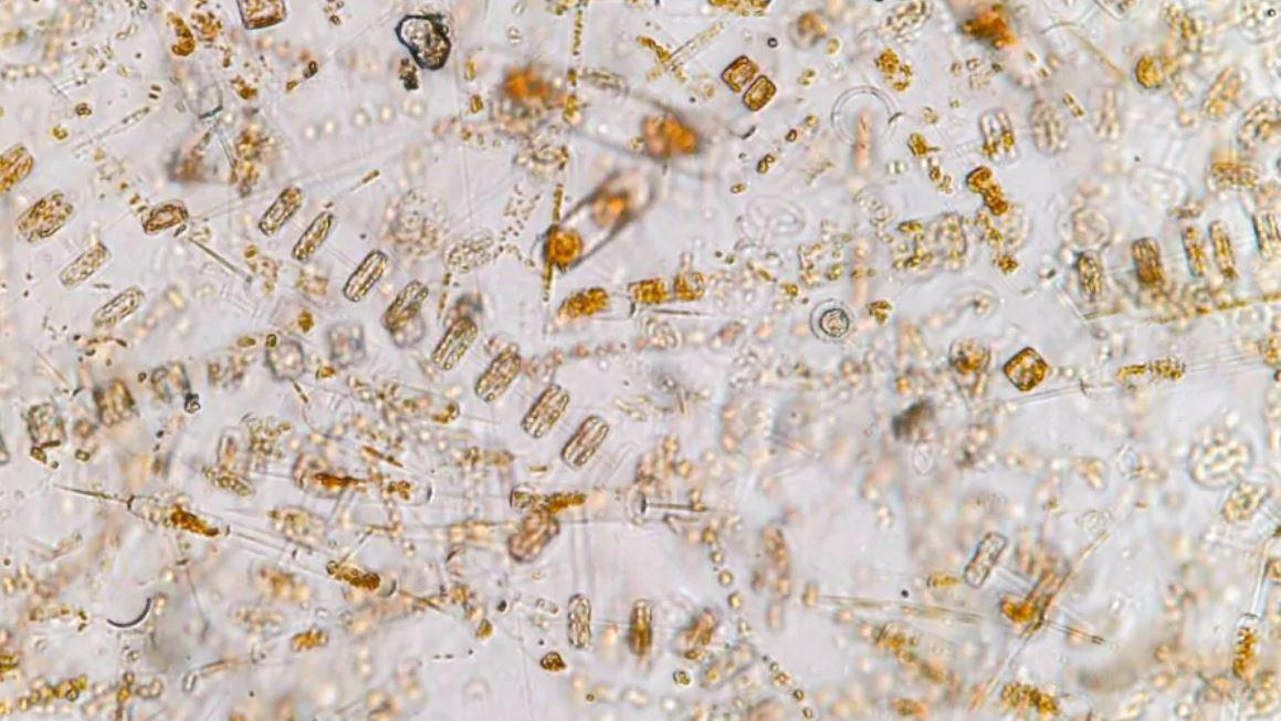 Micro-organismes marins vus sous un microscope. [Fondation Tara Océan - Maéva Bardy]