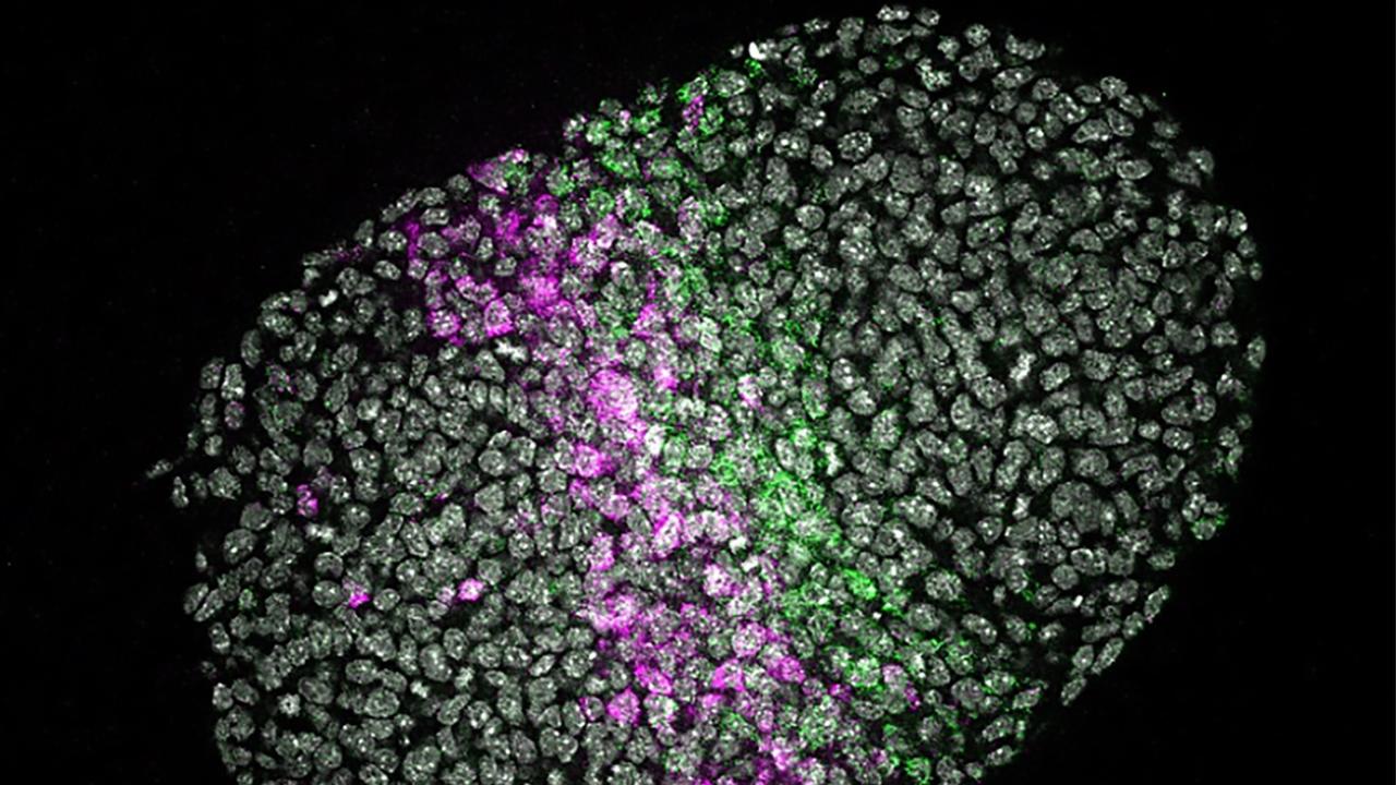 Les embryoïdes, des "pseudo-embryons", sont des structures cellulaires cultivées à partir de cellules souches, présentant
des caractéristiques similaires à celles d'un embryon en termes de composition et de développement et très utiles pour comprendre l'embryogénèse. [EPFL - Alexandre Mayran]