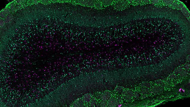 Cellules nerveuses nouvellement formées (en violet) dans le bulbe olfactif du cerveau d'une mère souris. (Image de microscopie à fluorescence: Université de Bâle, Biozentrum) [©Université de Bâle / Biozentrum]