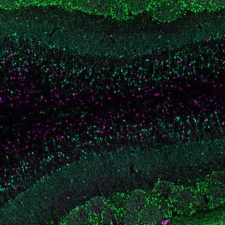 Cellules nerveuses nouvellement formées (en violet) dans le bulbe olfactif du cerveau d'une mère souris. (Image de microscopie à fluorescence: Université de Bâle, Biozentrum) [©Université de Bâle / Biozentrum]