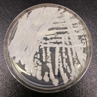 Une culture de Candida auris en boîte de Petri [Keystone - Shawn Lockhart/CDC via AP]