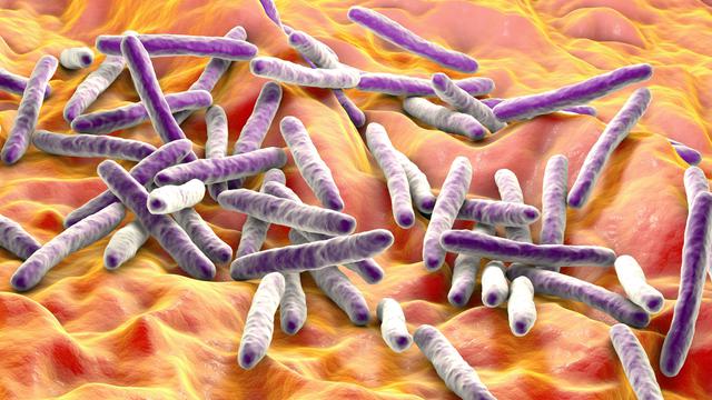 Mycobacterium tuberculosis, la bactérie responsable de la tuberculose. [AFP - KATERYNA KON / SCIENCE PHOTO LIBRARY]