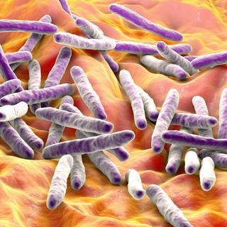 Mycobacterium tuberculosis, la bactérie responsable de la tuberculose. [AFP - KATERYNA KON / SCIENCE PHOTO LIBRARY]