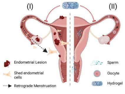 Fonctionnement de l'implant en hydrogel [Advanced Materials - Anthis AHC, Herrmann IK & al.]