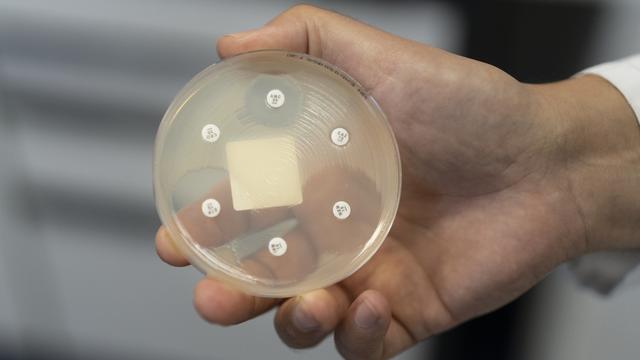 Des antibiotiques sont déposés sur un tapis de bactéries permettant de visualiser si l'antibiotique empêche la multiplication des bactéries. Le dispositif demontre une résistance des bactéries aux antibiotique, ce qui est le cas ici pour deux antibiotiques. CHUV, le 23 août 2022. [Keystone - Gaëtan Bally]