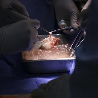 Des chirurgiens préparent le rein de porc génétiquement modifié avant la greffe sur un patient vivant, le 16 mars 2024 au Massachusetts General Hospital de Boston. [AFP PHOTO / MASSACHUSETTS GENERAL HOSPITAL / MICHELLE ROSE]