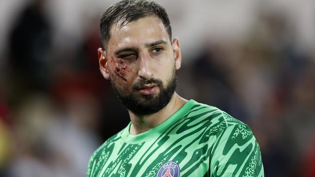 Gianluigi Donnarumma salement amoché. [Keystone - Sébastien Nogier]