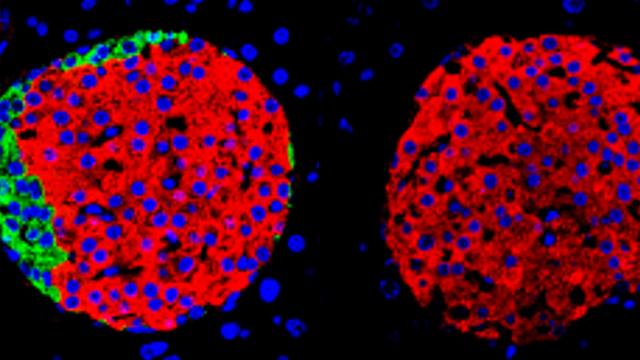 Îlots pancréatiques de souris adultes. À gauche: îlot composé de différents types de cellules endocrines. À droite: Îlot pancréatique composé uniquement de cellules bêta. [©Laboratoire Pedro Herrera - UNIGE]