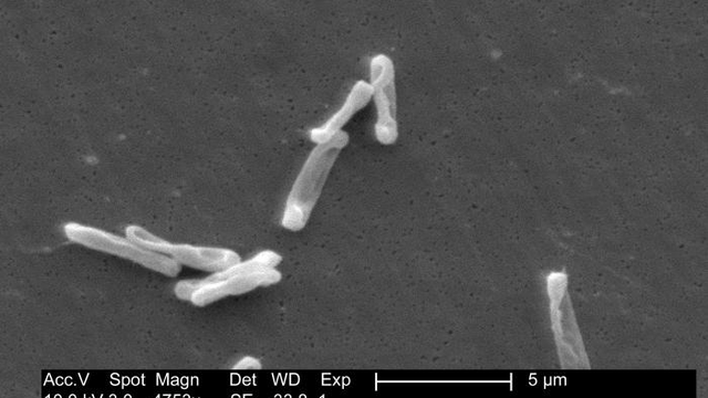 Transplanter les selles d’un donneur sain pour traiter les infections provoquées par la bactérie Clostridioides difficile (photo). [Domaine public - CDC/ Lois S. Wiggs]