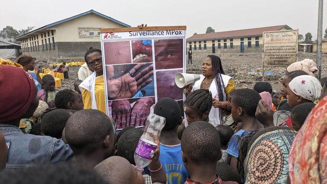 L'OMS a déclenché mercredi son plus haut niveau d'alerte face à la résurgence des cas de mpox. [Keystone]