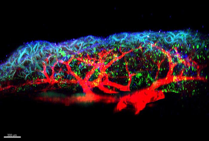 Visualisation en microscopie de cellules immunitaires (en vert) activées par les alarmines TL1A et interleukine-33 lors du déclenchement de l'inflammation allergique au niveau des poumons. [CNRS/UT3 PAUL SABATIER - JEAN-PHILIPPE GIRARD - IPBS]