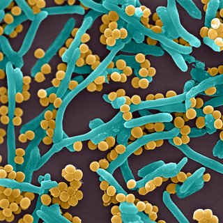 Trois bactéries du groupe ESKAPE: Staphylococcus aureus (jaune), Pseudomonas aeruginosa (bâtonnets courts et épais en bleu) et Escherichia coli​ (bâtonnets longs en bleu). ©UNIGE [©UNIGE - Karl Perron]