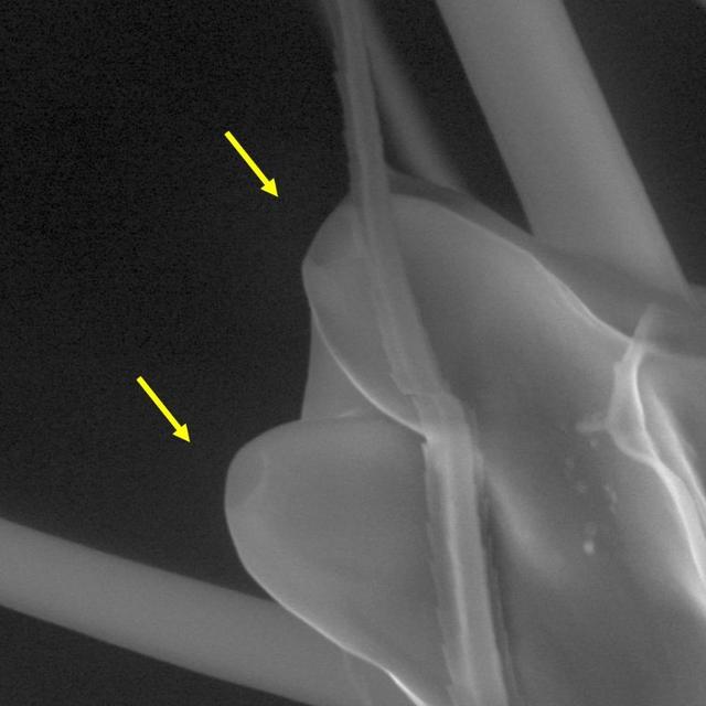 Les fosses situées à l'extrémité des antennes du moustique protègent les structures en forme de piquet qui détectent les infrarouges thermiques. [Nature - DeBeaubien, Chandel & al.]