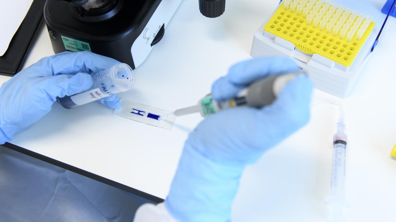 L'EPFL booste des cellules utilisées dans le traitement du cancer par immunothérapie. [Keystone - Laurent Gillieron]