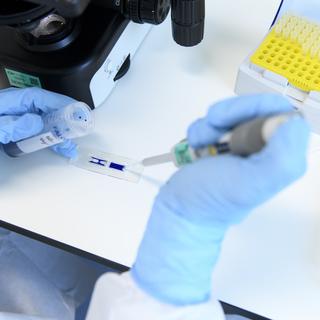 L'EPFL booste des cellules utilisées dans le traitement du cancer par immunothérapie. [Keystone - Laurent Gillieron]