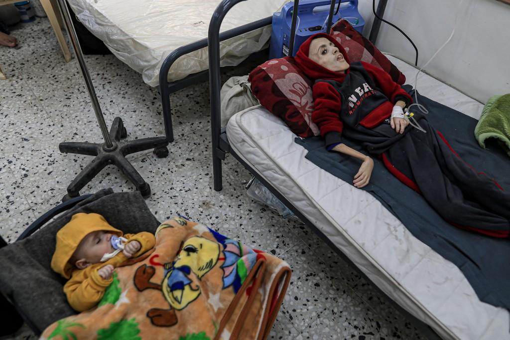 Selon l'OMS, au moins 10 enfants sont morts de faim dans le nord de Gaza. [Anadolu via AFP - JEHAD ALSHRAFI]