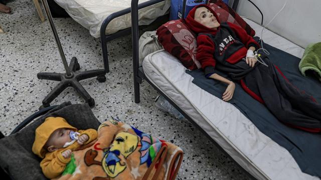 Selon l'OMS, au moins 10 enfants sont morts de faim dans le nord de Gaza. [Anadolu via AFP - JEHAD ALSHRAFI]