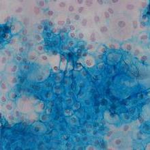Matrice extracellulaire de chondrocytes-Coloration au bleu Alcian. [CHUV - N.Busso]