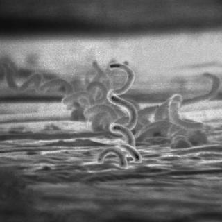 Le tréponème pâle, agent de la syphilis.
CDC / Dr. David Cox
Wikimédia [Wikimédia - CDC / Dr. David Cox]