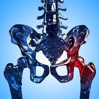 L'ostéoporose rend le squelette fragile.
Szabolcs Szekeres
Fotolia [Szabolcs Szekeres]