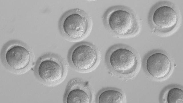 Des cellules souches embryonnaires.
EPA
Keystone [EPA]