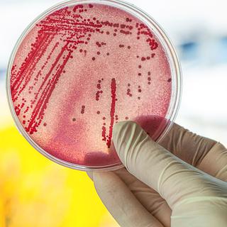 Les bactéries auraient différentes méthodes pour résister aux antibiotiques.
Photographee.eu
Fotolia [Photographee.eu]