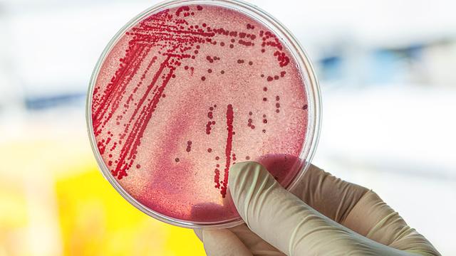 Les bactéries auraient différentes méthodes pour résister aux antibiotiques.
Photographee.eu
Fotolia [Photographee.eu]