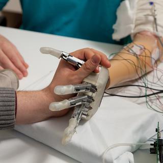 Une prothèse de la main redonne le sens du toucher à un patient amputé. [LifeHand2]