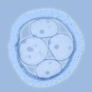 Le DPI permet de diagnostiquer des maladies génétiques chez l’embryon.
Juan Gärtner
Fotolia [Fotolia - Juan Gärtner]