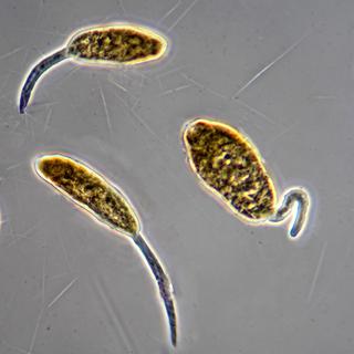 Larve à l'origine de la schistosomiase, la deuxième endémie parasitaire après le paludisme.
Biosphoto / Christian Gautier
AFP [AFP - Biosphoto / Christian Gautier]