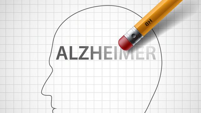 La maladie d'Alzheimer affecte notamment la mémoire.
Trifonenko Ivan
Fotolia [Trifonenko Ivan]
