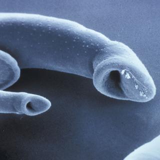 Vue au microscope de deux vers responsables de la bilharziose.
Chris Martin Bahr/Biosphoto
AFP [AFP - Chris Martin Bahr/Biosphoto]