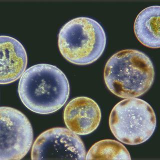 Des diatomées sous l'œil d'un microscope optique.
Jean Lecomte / BIOSPHOTO
AFP [Jean Lecomte / BIOSPHOTO]