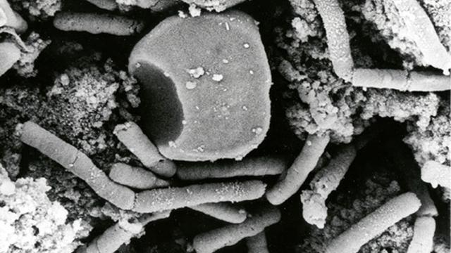 Bactérie: la bacillus anthracis responsable de l'anthrax. [Keystone - AP Photo/HO, Anthrax Vaccine Immunization Program]