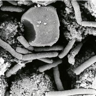 Bactérie: la bacillus anthracis responsable de l'anthrax. [Keystone - AP Photo/HO, Anthrax Vaccine Immunization Program]