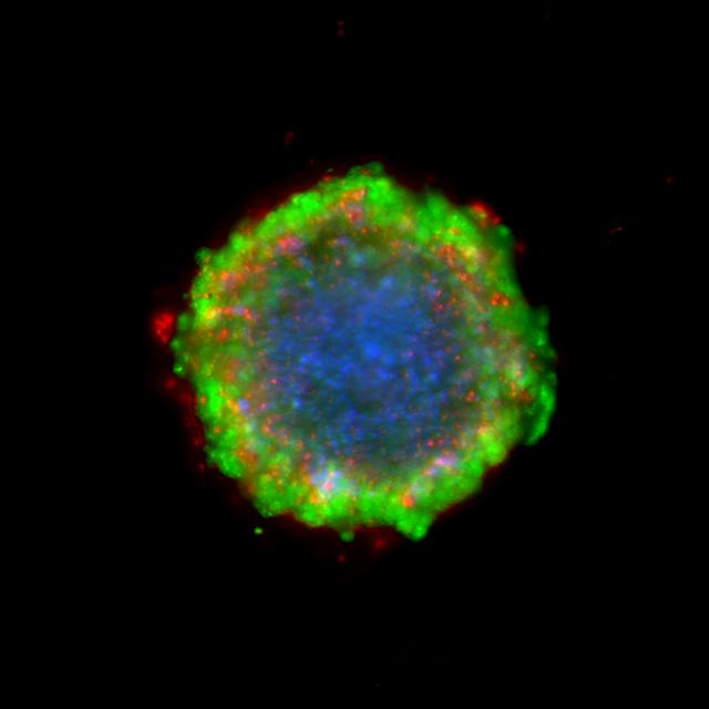 Image représentative d’un modèle 3D de carcinome colorectal exposé pendant 72 heures à un traitement par une association de trois médicaments.
Nowak-Sliwinska Patrycja
Unige [Unige - Nowak-Sliwinska Patrycja]