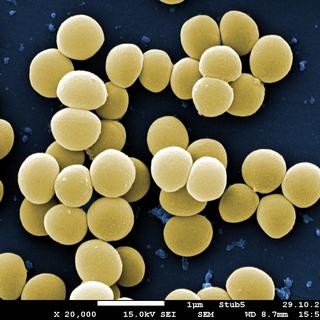 Staphylocoques dorés (en jaune) vus au microscope électronique.
img avec CP Unige
UNIGE [UNIGE]