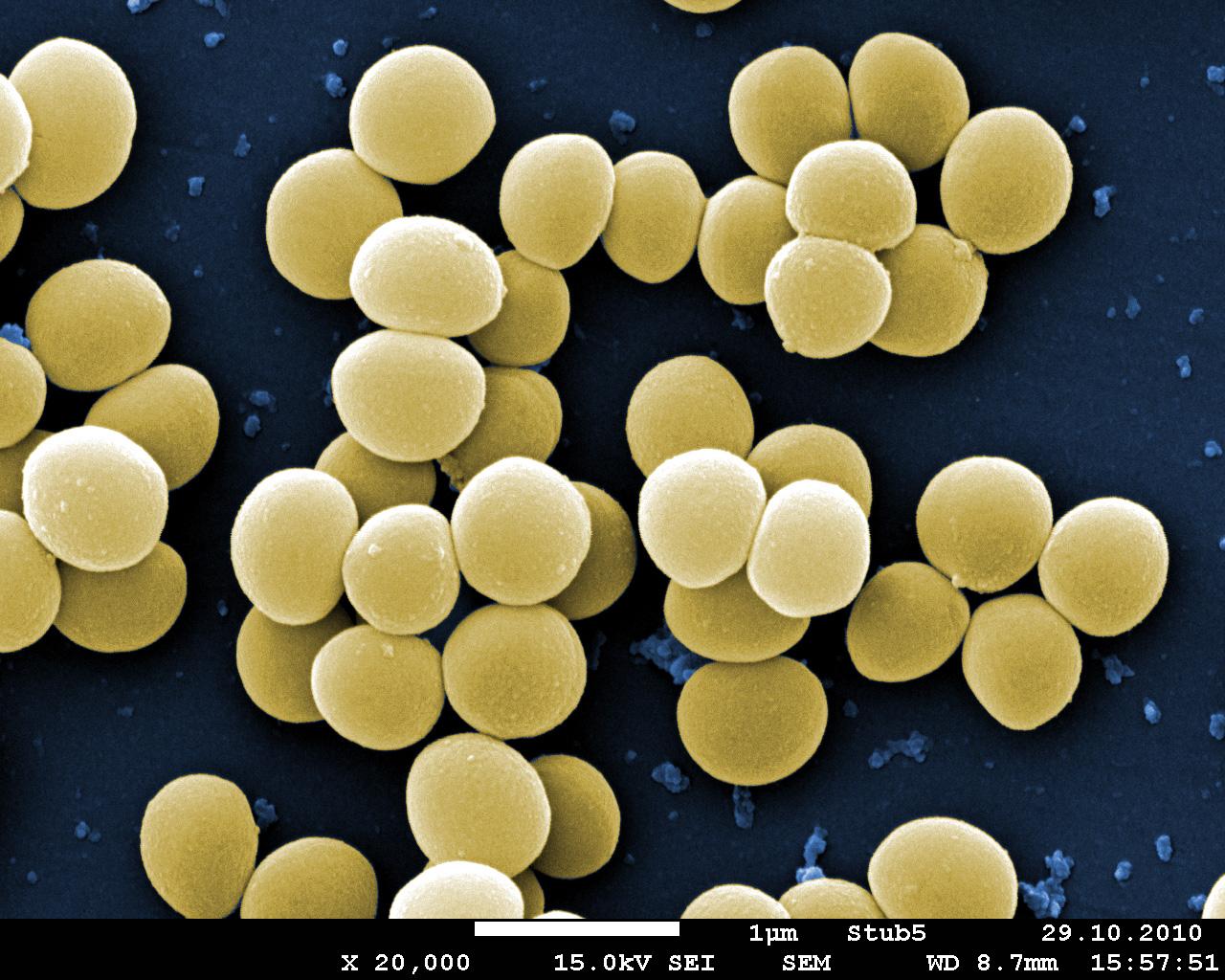 Staphylocoques dorés (en jaune) vus au microscope électronique. [UNIGE]