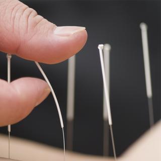 Les aiguilles d'acupuncture ne vont pas assez profond pour être en contact avec du sang. Acupuncteur Berne Sida. [max tactic]