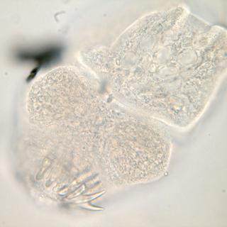 Une larve d’échinocoque avec les crochets typiques qui ont donné le nom au parasite.
Gilbert Greub [Gilbert Greub]