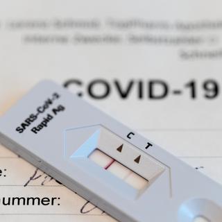 Les tests de dépistage rapide du Covid-19 peuvent être réalisés en pharmacie sous certaines conditions. [Keystone - Gaetan Bally]