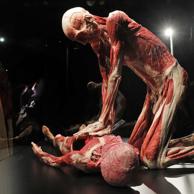 L'exposition itinérante propose des cadavres humains plastinés et des squelettes. [AP/Keystone - Frank Augstein]