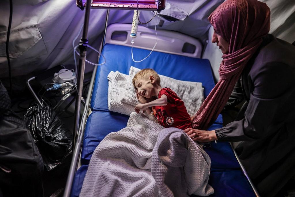 Fadi, 9 ans, souffre de malnutrition. Il a dû être transféré de l'hôpital Kamal Adwan, dans le nord de la bande de Gaza, au poste-frontière de Rafah, en attendant son transfert en dehors de l'enclave palestinienne. [AFP - ALI JADALLAH]