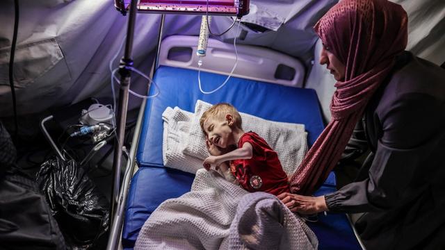 Fadi, 9 ans, souffre de malnutrition. Il a dû être transféré de l'hôpital Kamal Adwan, dans le nord de la bande de Gaza, au poste-frontière de Rafah, en attendant son transfert en dehors de l'enclave palestinienne. [AFP - ALI JADALLAH]