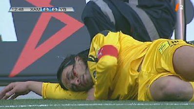 Football/Super League: la blessure d'Hakan Yakin