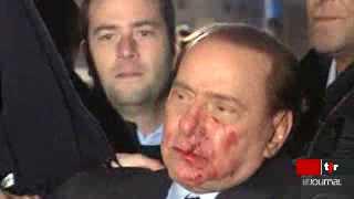 Agression de Silvio Berlusconi: le président du Conseil italien est toujours hospitalisé