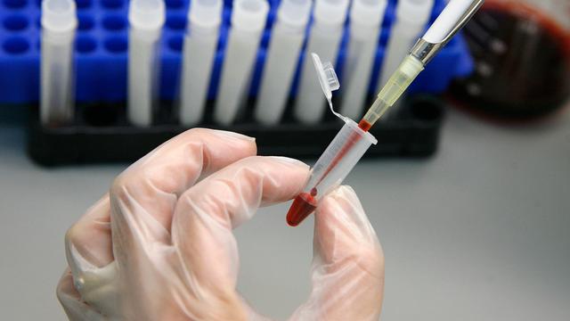 Un nouveau vaccin permet de limiter le taux de contamination du sida.