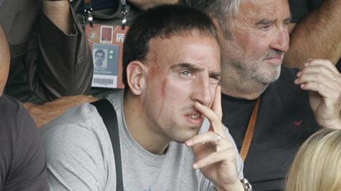 Franck Ribéry a été entendu dans cette affaire.